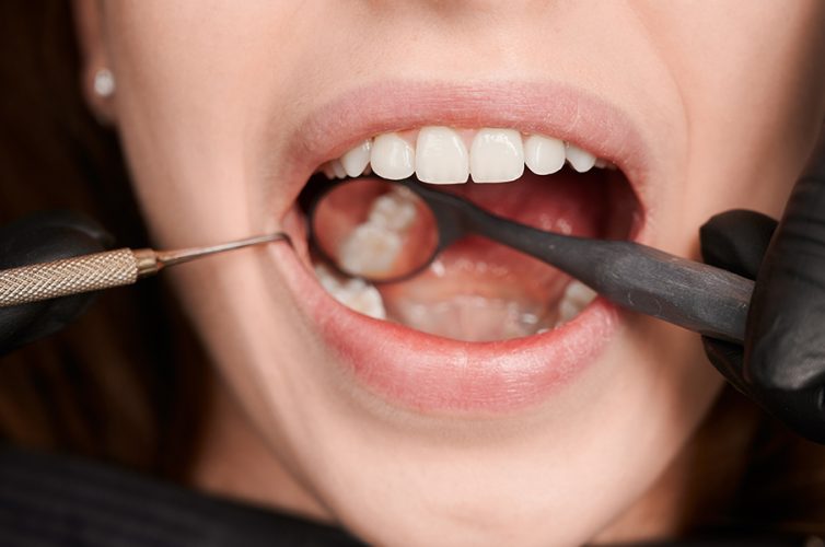 Close-up, cropped snapshot of good looking woman at dentist office during teeth checkup. Dentist examining patient's teeth with mirror and explorer. Oral hygiene concept